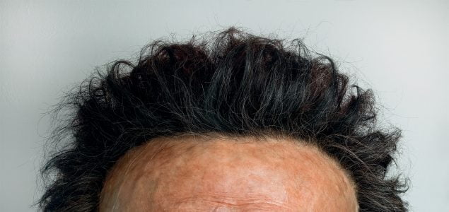 Philip II Macedonian